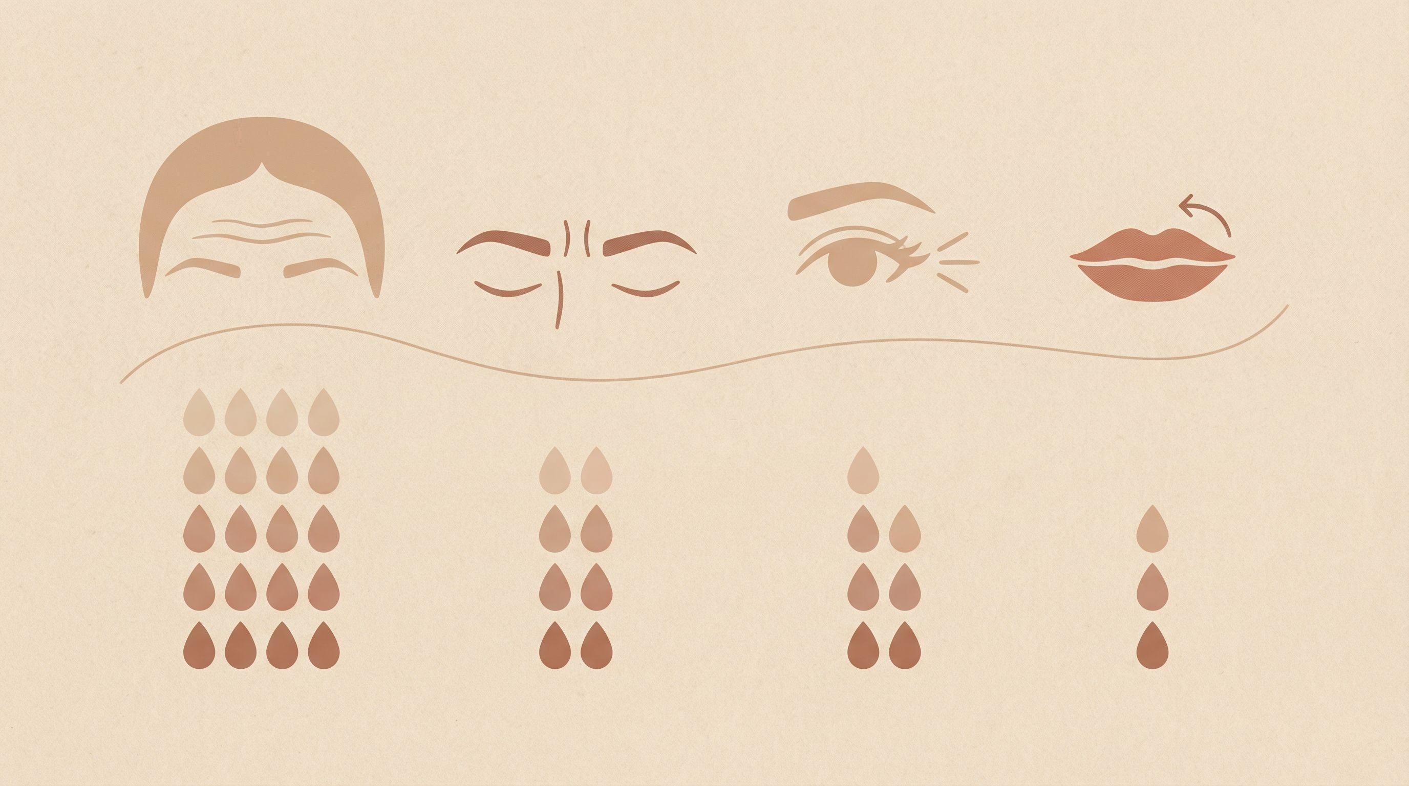 Visual comparison of Botox units for different facial treatment areas